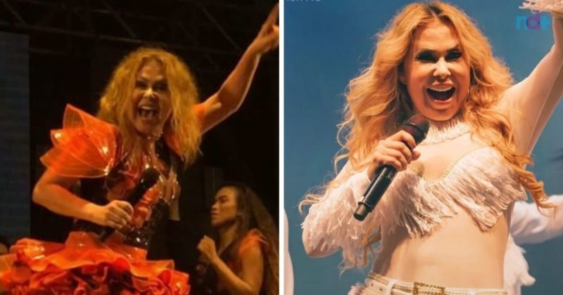 Joelma assusta f&atilde;s ao aparecer com rosto inchado – Foto: Reprodu&ccedil;&atilde;o/Internet