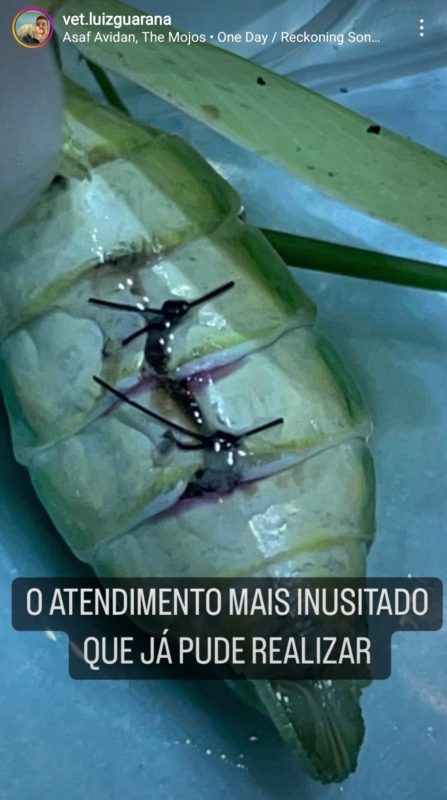 Imagem dos pontos realizados durante a cirurgia chamou a aten&ccedil;&atilde;o nas redes sociais – Foto: Reprodu&ccedil;&atilde;o/Alessandro Bijjeni/Instagram