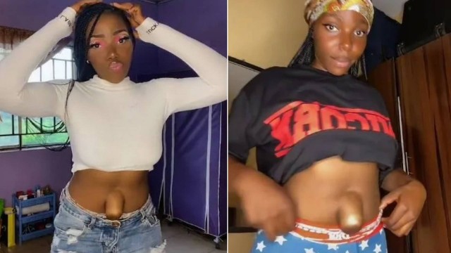 Chi exibe umbigo protuberante – Foto: Reprodu&ccedil;&atilde;o/TikTok/ND