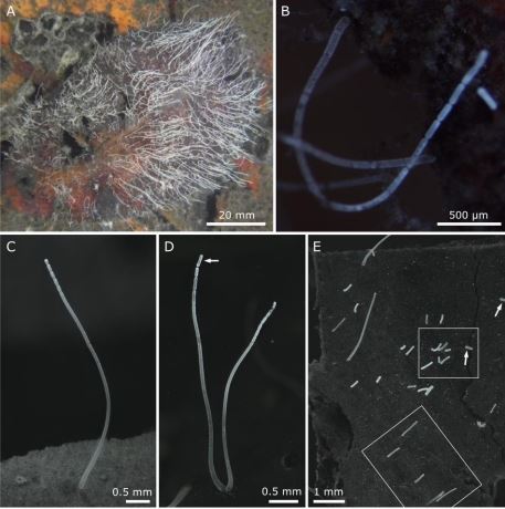 As pepinas cont&ecirc;m n&atilde;o apenas DNA, mas tamb&eacute;m ribossomos, organelas respons&aacute;veis pela s&iacute;ntese de prote&iacute;nas. – Foto: Science/Divulga&ccedil;&atilde;o/ND