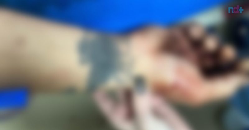 Homem foi morto a tiros pr&oacute;ximo a empresa do bairro Salseiros em Itaja&iacute; – Foto: Reprodu&ccedil;&atilde;o/ND