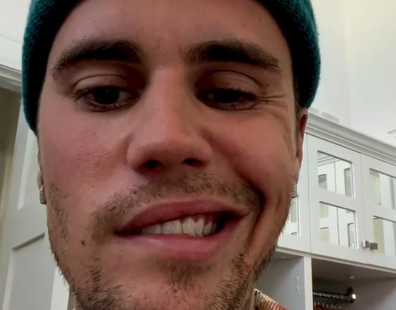 VÍDEO: &#39;Não consigo sorrir deste lado do rosto&#39;, entenda a síndrome que afeta Justin Bieber
