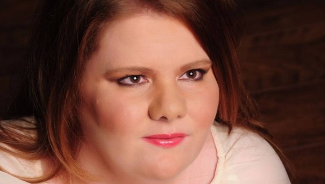 Kelly Fidoe-White, de 41 anos, sofre de uma condi&ccedil;&atilde;o rar&iacute;ssima. – Foto: Internet/ND