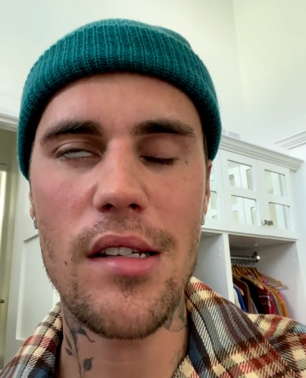 S&iacute;ndrome &eacute; respons&aacute;vel por paralisar parte do rosto do cantor – Foto: Reprodu&ccedil;&atilde;o/Instagram/Divulga&ccedil;&atilde;o/ND