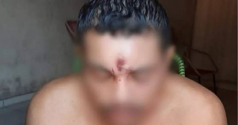 The shot hit the motorcyclist in the forehead, but the expert explains why he is still alive - Photo: Reproduction