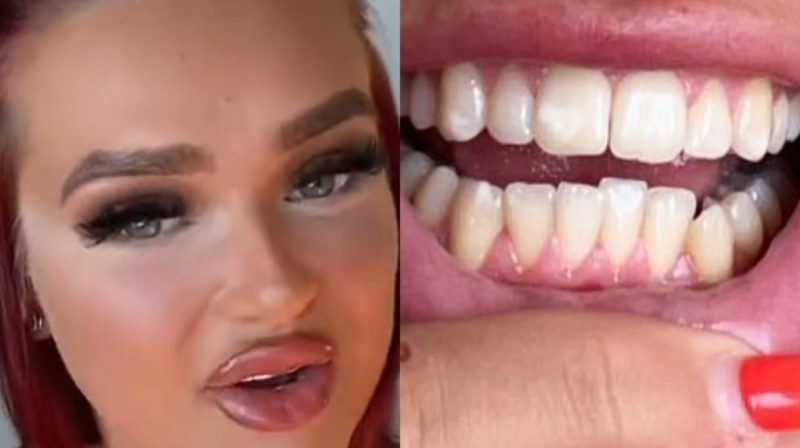 Mulher fez a transforma&ccedil;&atilde;o em seu sorriso e compartilhou com seus seguidores – Foto: Reprodu&ccedil;&atilde;o/Internet/ND