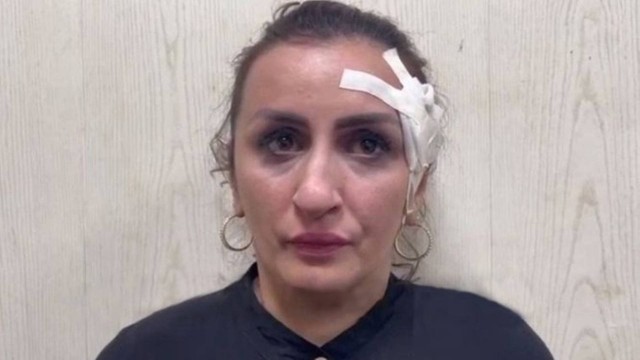 Russa vendeu seu beb&ecirc; para financiar pl&aacute;stica no nariz – Foto: Reprodu&ccedil;&atilde;o/ND