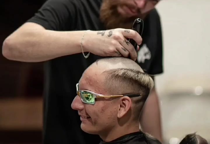 Corte de cabelo 'chavoso' em mulher choca por simular efeitos da calvície