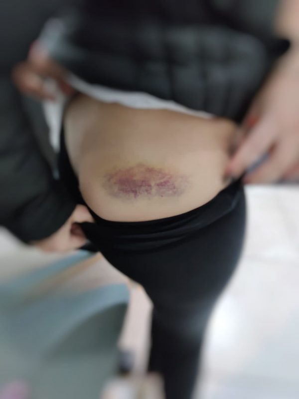 V&iacute;tima estava com diversas marcas de agress&atilde;o no corpo – Foto: Pol&iacute;cia Militar/Divulga&ccedil;&atilde;o