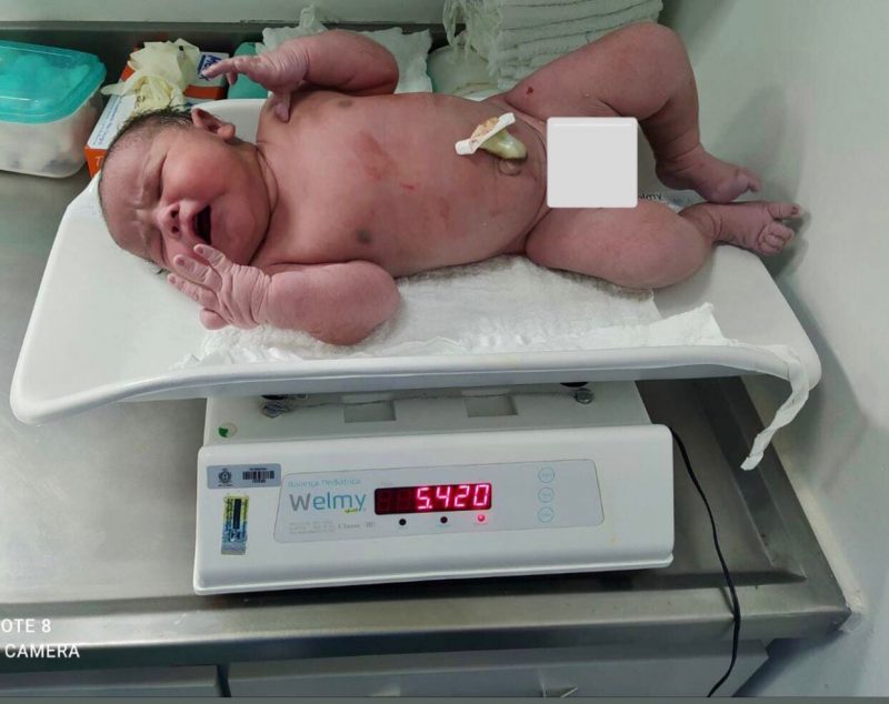 O beb&ecirc; &eacute; o segundo maior que j&aacute; nasceu no hospital de S&atilde;o Miguel do Oeste. – Foto: HRTGB/Divulga&ccedil;&atilde;o/ND