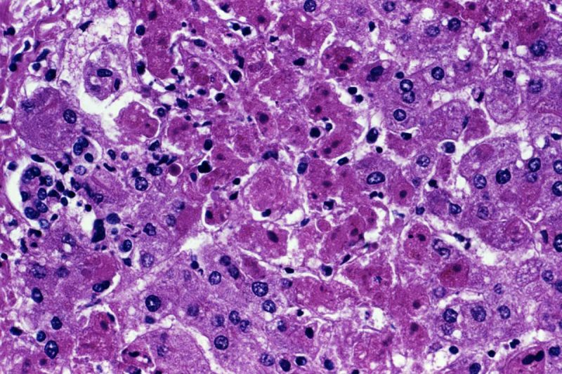 V&iacute;rus de Marburg registrou taxa de mortalidade de 24% at&eacute; 88% em surtos anteriores – Foto: Africa CDC/Divulga&ccedil;&atilde;o/ND