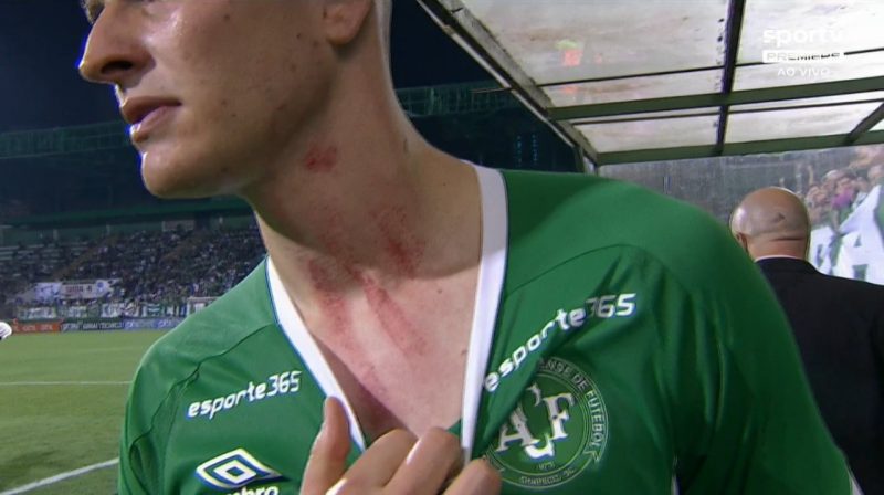 Pedro Perotti mostra les&atilde;o no pesco&ccedil;o &mdash; Foto: Reprodu&ccedil;&atilde;o/Edu Cesar/Papo de Bola/Twitter