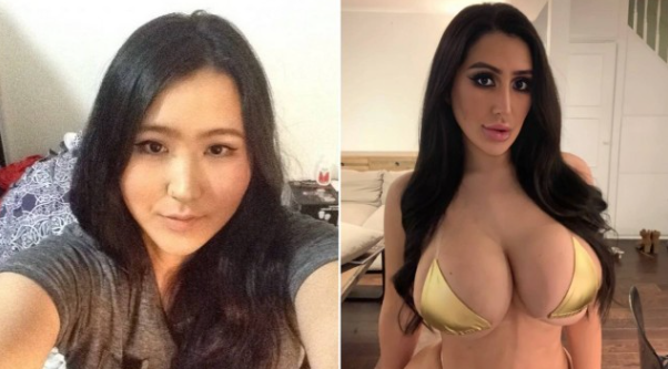 Sul-coreana Cherri Lee gastou R$ 310 mil em 15 cirurgias para ter corpo de Kim Kardashian – Foto: Internet/Reprodu&ccedil;&atilde;o/ND