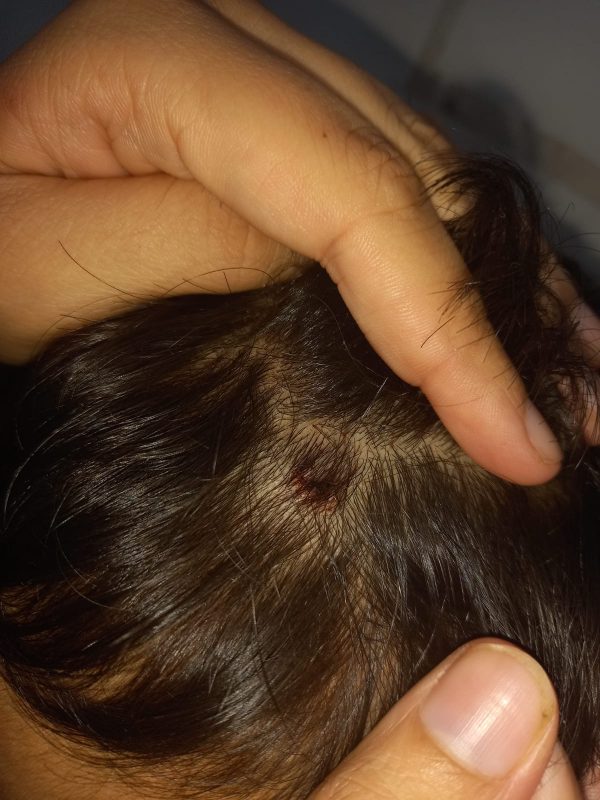 Beb&ecirc; de 2 anos foi agredido pelo tio b&ecirc;bado em Navegantes – Foto: Reprodu&ccedil;&atilde;o/ND