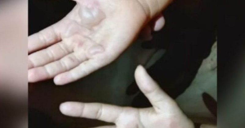 Vizinhos levaram o caso &agrave;s autoridades, depois que as meninas bateram &agrave; porta pedindo pomada – Foto: Reprodu&ccedil;&atilde;o