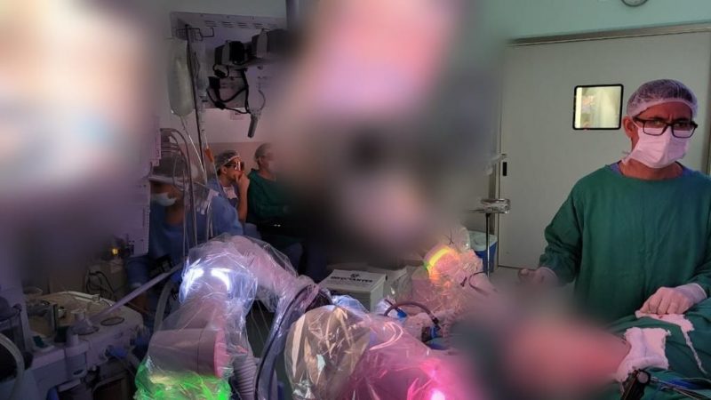 Cirurgia foi feita utilizando sinal da tecnologia 5G – Foto: Hospital de Caridade/Divulga&ccedil;&atilde;o/ND