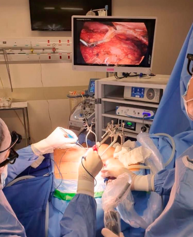 Pro Cuore surgeons during surgery: cutting-edge technology accelerates patient recovery – Photo: Disclosure/ND
