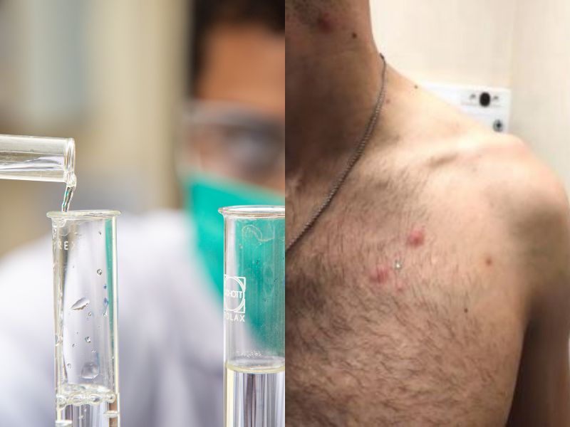 Homem recebeu o diagn&oacute;stico errado de &oacute;rg&atilde;o de sa&uacute;de municipal – Foto: Unsplash + CDC/Divulga&ccedil;&atilde;o/ND