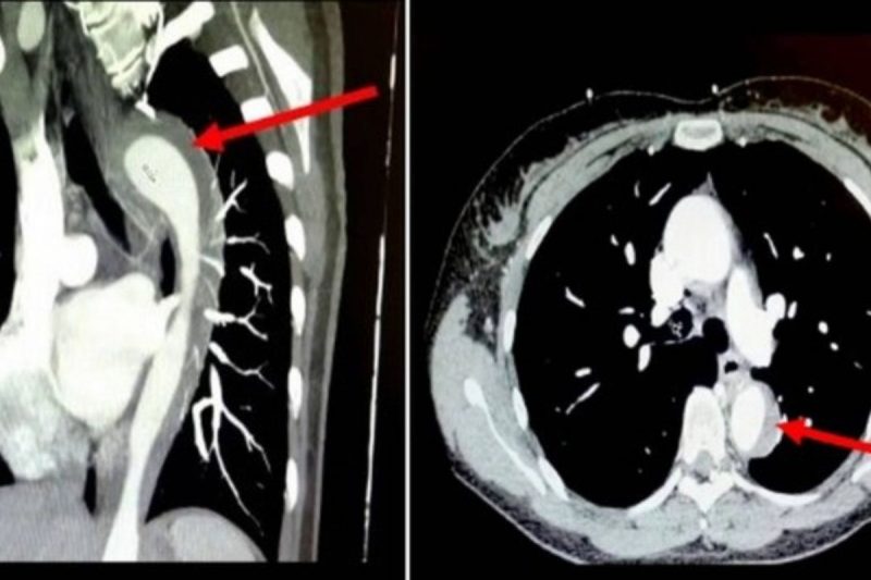 Caso &eacute; considerado incomum e pode ser fatal – Foto: Reprodu&ccedil;&atilde;o/Internet