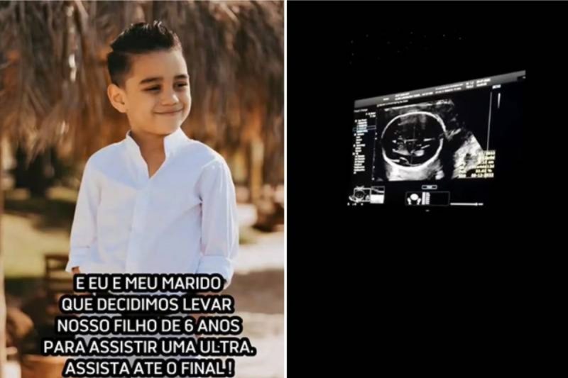 Benjamin viralizou na internet com rea&ccedil;&atilde;o durante ultrassom do irm&atilde;ozinho – Foto: Reprodu&ccedil;&atilde;o/Instagram