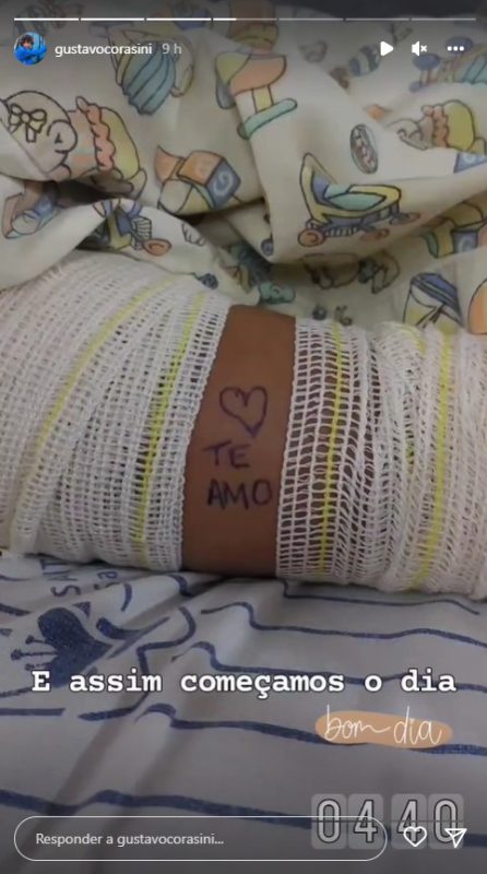 Gustavo teve uma perna e um bra&ccedil;o quebrados e parte da bacia fraturada – Foto: Divulga&ccedil;&atilde;o/@gustavocorasini/ND