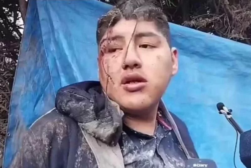 O boliviano acordou preso em caix&atilde;o a 80 km do festival em que estava – Foto: Internet/Reprodu&ccedil;&atilde;o/ND