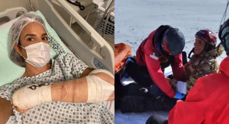 Ivete Sangalo sofre acidente enquanto esquiava no Chile – Foto: Internet/Reprodu&ccedil;&atilde;o/ND