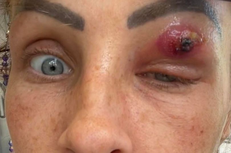 The woman had vision problems – Facebook Louise Edwards/Daily Star/Disclosure/ND
