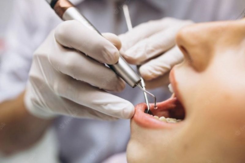 Dentista trabalhando na boca de um paciente