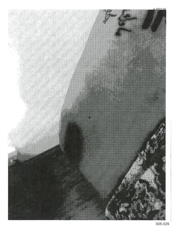 Outra foto constata um hematoma no cotovelo da atriz – Foto: Reprodu&ccedil;&atilde;o