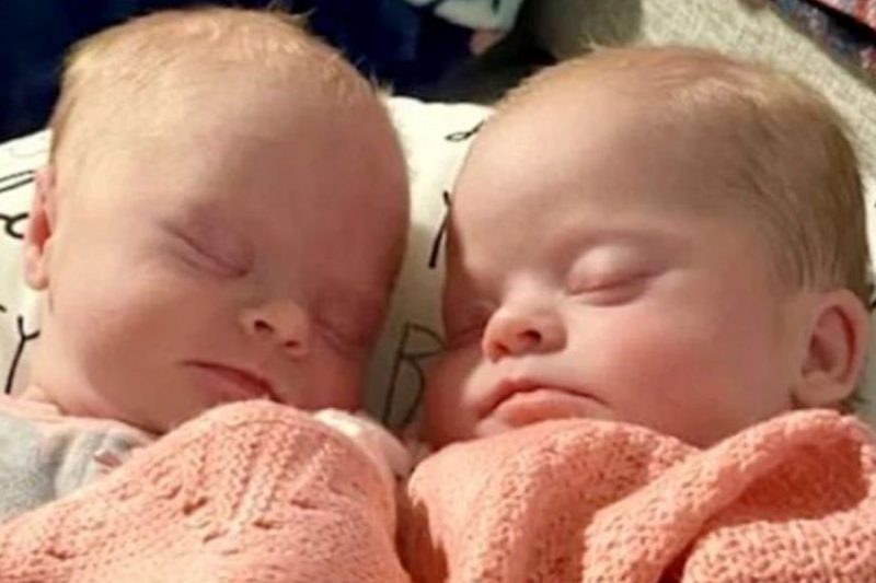 Beb&ecirc;s fazem parte de caso caro de g&ecirc;meas com s&iacute;ndrome de Down – Foto: Savannah Combs/Reprodu&ccedil;&atilde;o