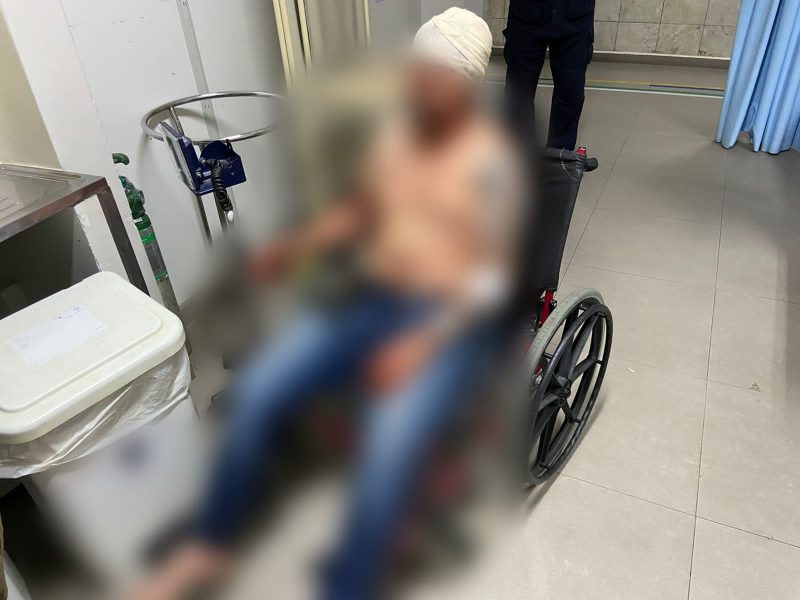 Comerciante &eacute; brutalmente espancado por retalia&ccedil;&atilde;o ap&oacute;s suposta den&uacute;ncia de tr&aacute;fico em Itaja&iacute; – Foto: Pol&iacute;cia Militar/Divulga&ccedil;&atilde;o/ND