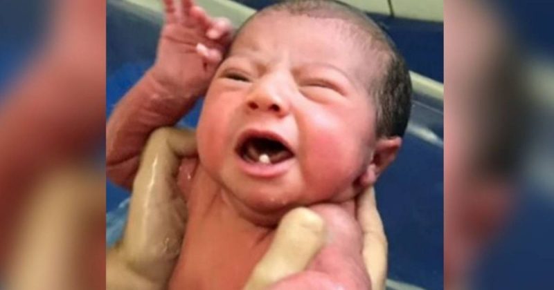 The baby surprised parents and doctors with her teeth, but her health is excellent - Photo: Reproduction