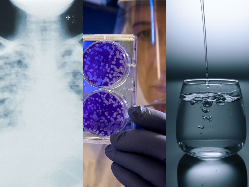 Bact&eacute;ria que causou surto na Argentina pode ser encontrada na &aacute;gua – Foto: Unsplash/Divulga&ccedil;&atilde;o/ND