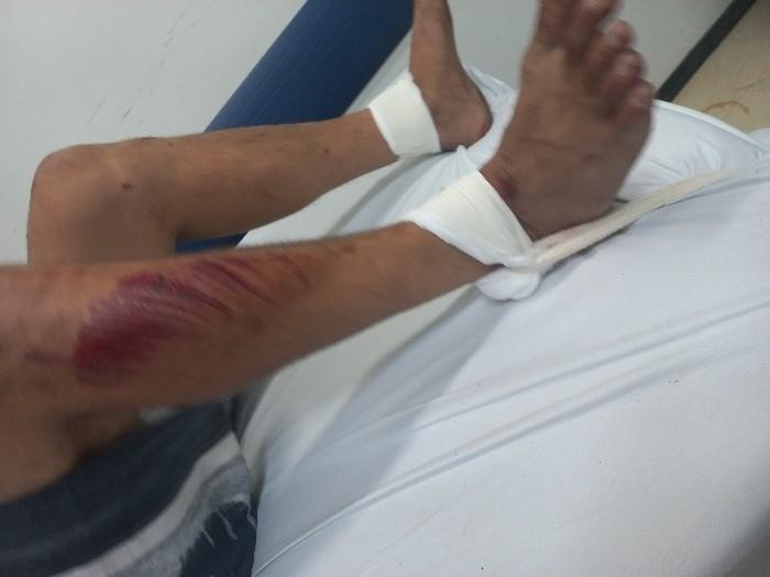 Homem teve cortes na perna e na cabe&ccedil;a – Foto: Pol&iacute;cia Militar Itaja&iacute;/Reprodu&ccedil;&atilde;o/ND