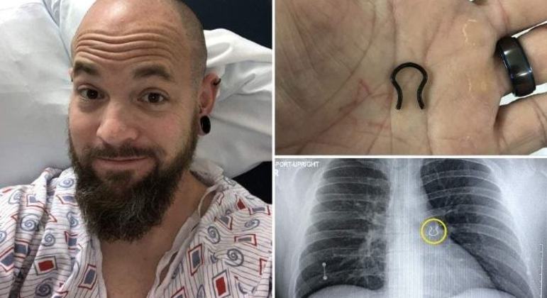 Joey foi para o hospital ap&oacute;s ter tosse e dificuldade para respirar – Foto: REPRODU&Ccedil;&Atilde;O/JOEY LYKINS/NY POST