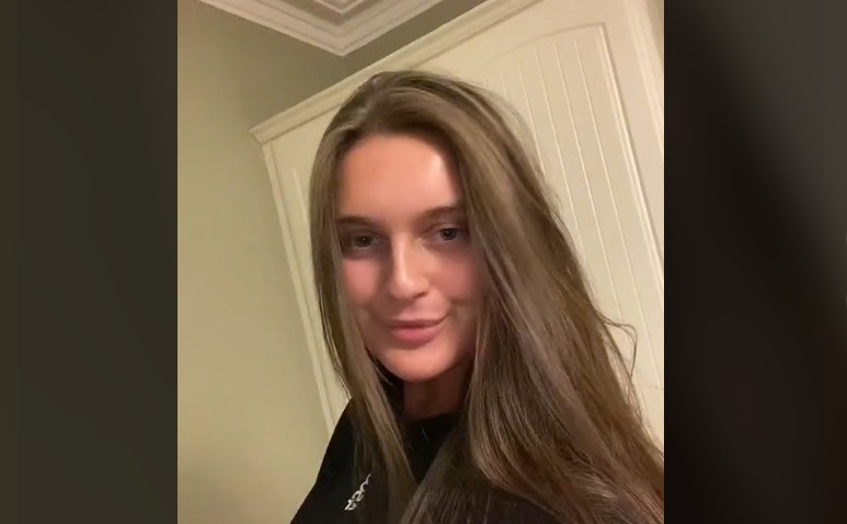 Mulher faz preenchimento labial e foi comparada ao Pato Donald – Foto: Reprodu&ccedil;&atilde;o/rubyyfrais/ND