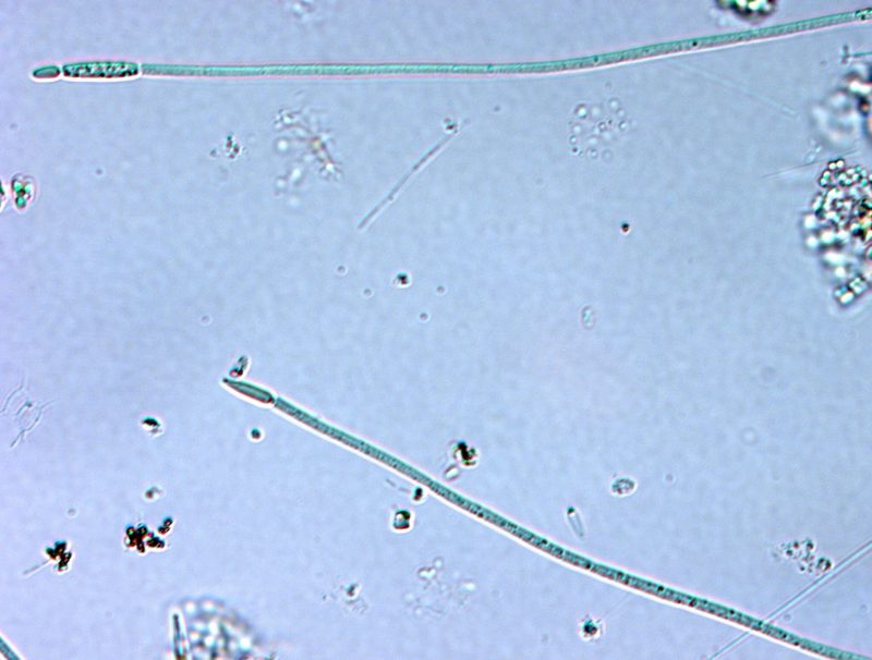 Ilustra&ccedil;&atilde;o de uma cianobact&eacute;ria – Foto: Creative Commons/Divulga&ccedil;&atilde;o/ND