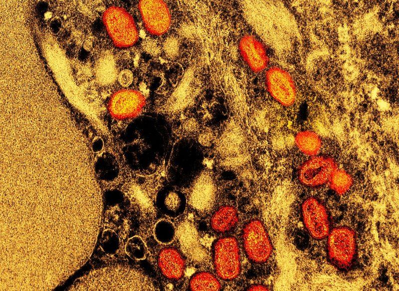 Micrografia eletr&ocirc;nica de transmiss&atilde;o colorida de part&iacute;culas de var&iacute;ola de macaco (laranja) encontradas dentro de uma c&eacute;lula infectada (marrom e amarela), cultivadas em laborat&oacute;rio – Foto: NIAID/Reprodu&ccedil;&atilde;o/ND