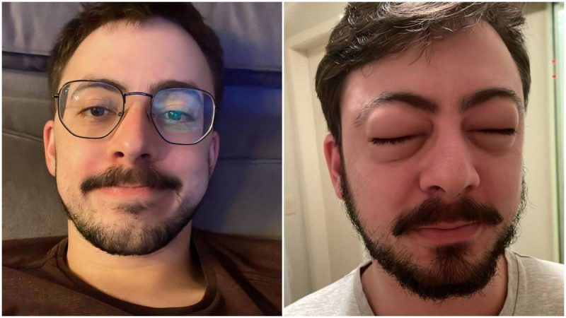 ‘Dieta de lascar. O m&eacute;dico disse que eu posso comer tudo, menos os frutos do mar’: m&uacute;sica de Jo&atilde;o Bosco cai como luva para o m&eacute;dico Samuel Cust&oacute;dio – Foto: Reprodu&ccedil;&atilde;o