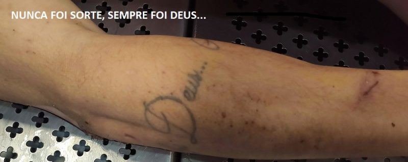 IML divulgou a foto da tatuagem do homem. – Foto: IML/Divulga&ccedil;&atilde;o/ND