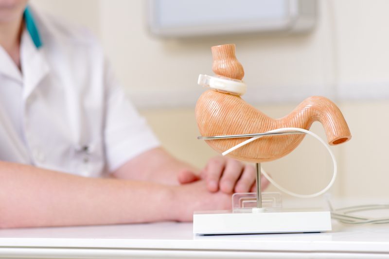 Clinical treatment, endoscopic balloon or bariatric surgery are options for the development of medicine and the fight against overweight.  Photo: Disclosure