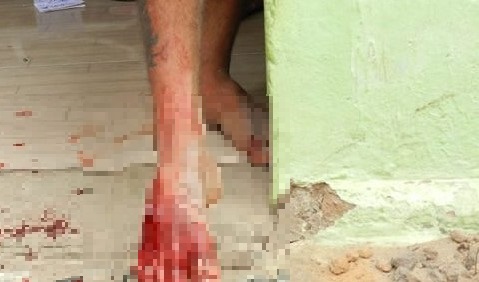 O homem ferido no p&eacute; com tiro de pistola diz a causa foi uma discuss&atilde;o pol&iacute;tica – Foto: Reprodu&ccedil;&atilde;o/Internet/ND