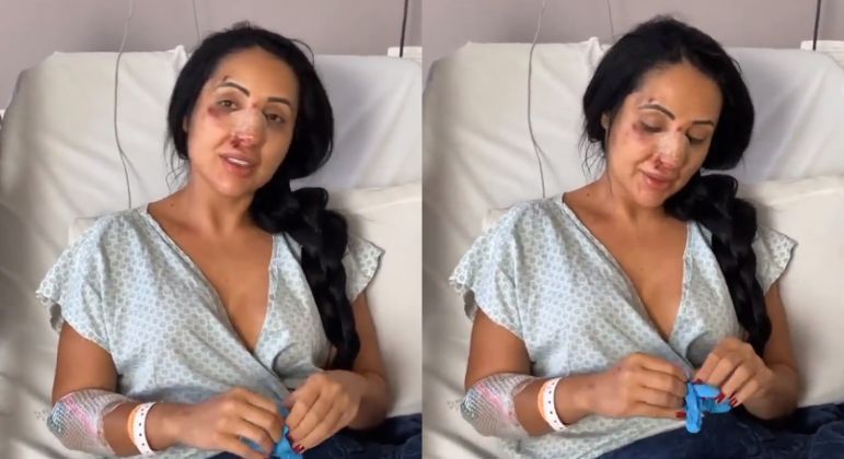 Daniele apareceu em hospital com diversos machucados ap&oacute;s briga – Foto: Reprodu&ccedil;&atilde;o/Internet/ND