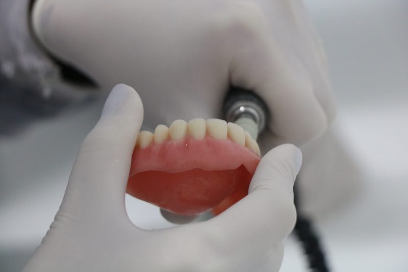 Moradores de Nova Veneza, no Sul de SC, v&atilde;o receber pr&oacute;teses para voltar a sorrir. – Foto: Divulga&ccedil;&atilde;o