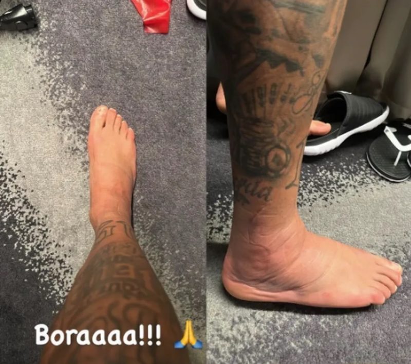 Neymar segue com o tornozelo bastante inchado
