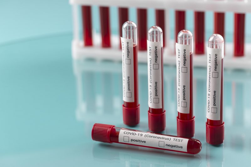 &Uacute;ltimas mortes por coronav&iacute;rus em Blumenau ocorreram em junho – Foto: Divulga&ccedil;&atilde;o/Freepik/ND