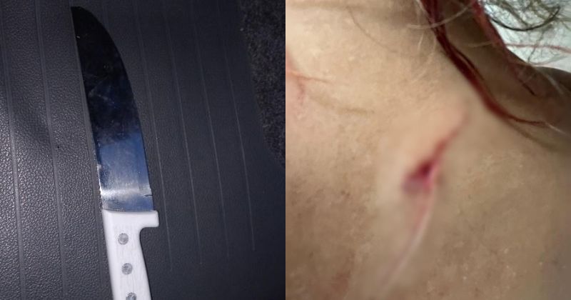 V&iacute;tima levou facadas profundas e precisar&aacute; passar por cirurgia – Foto: Pol&iacute;cia Militar/Reprodu&ccedil;&atilde;o/ND