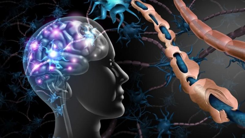 Pode haver liga&ccedil;&atilde;o do&nbsp;v&iacute;rus Epstein-Barr com a doen&ccedil;a chamada esclerose m&uacute;ltipla. Trata-se de uma doen&ccedil;a neurol&oacute;gica cr&ocirc;nica caracterizada pela inflama&ccedil;&atilde;o da mielina, membrana que envolve os neur&ocirc;nios. A inflama&ccedil;&atilde;o ocorre devido ao sistema imunol&oacute;gico que n&atilde;o reconhece a membrana como parte do organismo, destruindo-a.&nbsp; – Foto: Reprodu&ccedil;&atilde;o