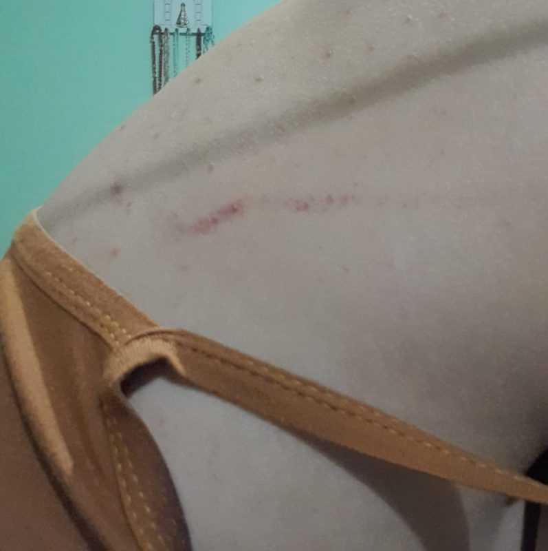 Jovem sofreu arranh&otilde;es ap&oacute;s ser tirada &agrave; for&ccedil;a de festa – Foto: Arquivo Pessoal/ND